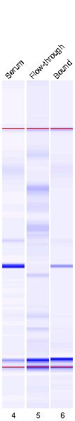 Immunodepletion with Multiple Affinity Removal Column Fluoresce nce 45 4 35 3 25 2 15 lower marker system peak Serum albumin Serum upper marker Bioanalyzer 21 - provides