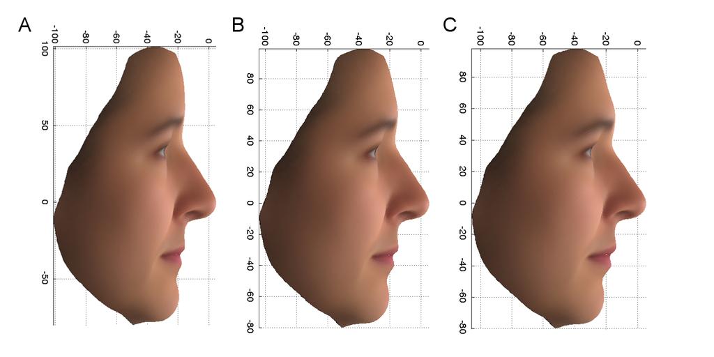 Figure 2 PC2 profile: Average faces, using the original variables, for 14 East Asian females (A) and the upper 10% (more East Asian) (B) and lower 10% (more European) (C) extremes of the PoBI females.