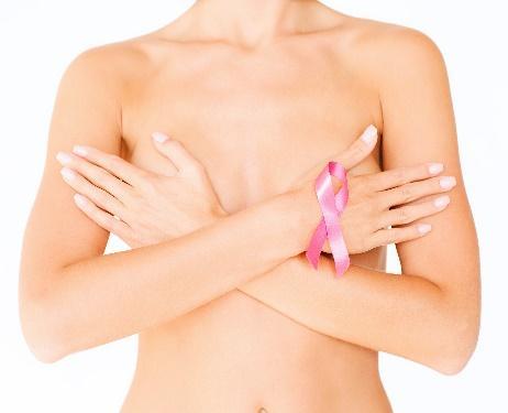 Breast cancer update Iryna Kuchuk, MD