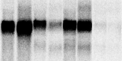 Facilitating Late Lentiviral Gene Expression 1 2 2 syn-gag? cis active repressor degradation sequenzes wt - gag splicing machinery 3?