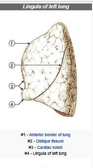 31 Lung Anatomy The lingula, found only in the left lung, is a projection of the upper lobe of