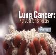 *Passive smoking - 2 nd hand smoke *Occupational carcinogens *