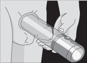 Vacuum Erection Device In patients who only have partial erections or who either do not respond to other treatments or prefer not to use them, a vacuum erection device maybe helpful.