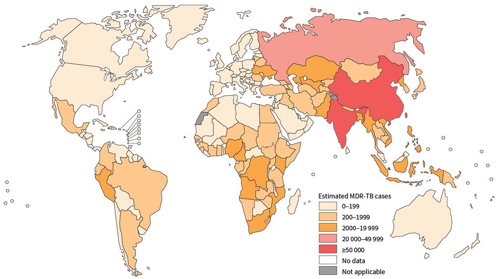 More than half of the global burden of MDR-TB is in three countries - India, China and