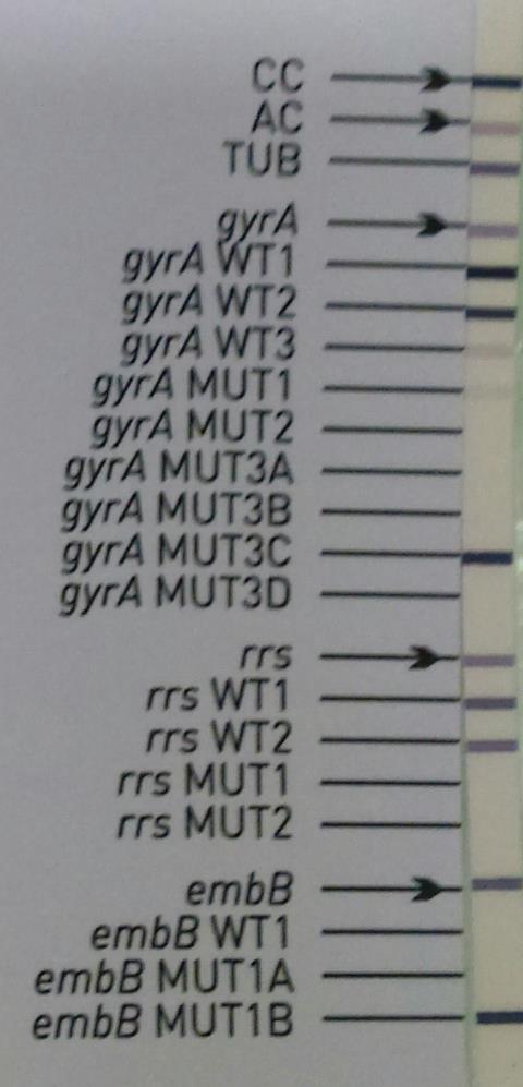 codons MUT probes mutation WT1 14011402 rrs MUT 1