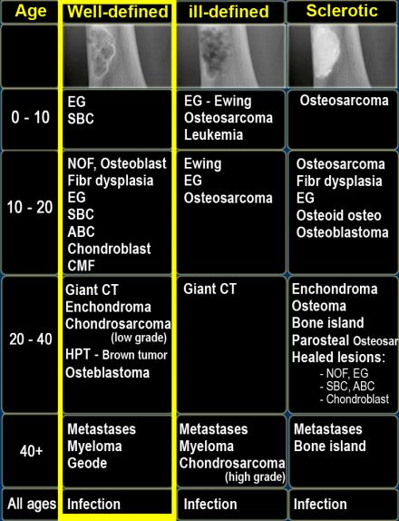 On the left a table with well-defined osteolytic bone tumors and tumor-like lesions in different age-groups.
