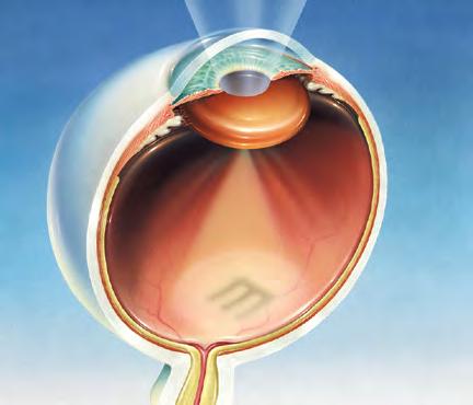 The Human Eye Cornea