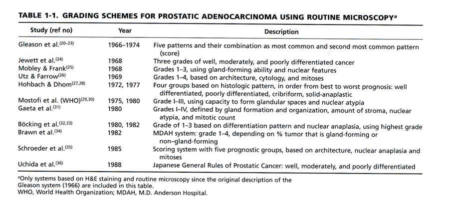 Grading Cancers of the Prostate: Prostatic adenocarcinoma (> 99%) Acinar type atrophic, foamy, pseudohyperplastic, others Ductal type Mucinous type Vacuolated type (signet ring cell-like) Grading