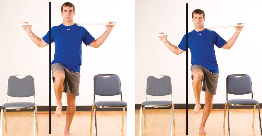 Hurdle Step Screen: Frontal View Observations First repetition Observe the stability of the foot. Second repetition Observe the alignment of the stance-leg knee over the foot.