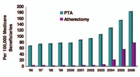 A B C D Figure 2. Frequency of endovascular procedures in the FP artery between 1996 and 2006 per 100,000 Medicare beneficiaries. Adapted from Goodney et al. J Vasc Surg (2009;50:54-60).