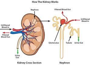 Dialysis is the artificial process of eliminating waste (diffusion) and unwanted water (ultrafiltration) from