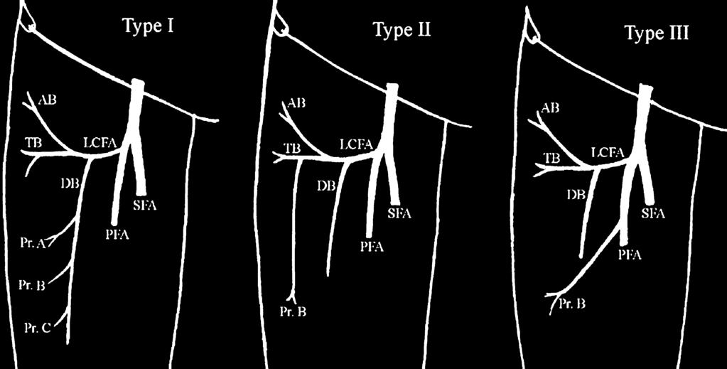 B) originates from the profundus femoris artery (PFA) directly. SFA, superficial femoral artery; LCFA, lateral circumflex femoris artery; AB, ascending branch.