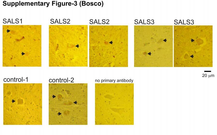 Supplementary Figure 3. Immunohistochemistry of human spinal cord tissues with a commercial, polyclonal anti-sod1 antibody.