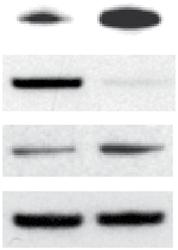 Chnges in -My expression with LY2942 tretment were rogted in Gsk3 / ; Gsk3 loxp/loxp ; ortil ultures. The derese in phospho-akt nd phospho GSK-3β showed the effiieny of PI3K inhiition.