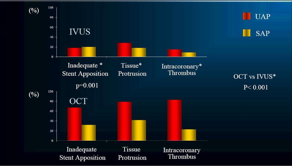 OPTICAL COHERENCE TOMOGRAPHY (OCT) vs IVUS T.