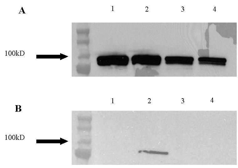 Figure 19. Western blot confirms differential protein phosphorylation in distinct cell types. PBMC were separated into monocytes and lymphocytes and were either treated with IL-2 or left untreated.