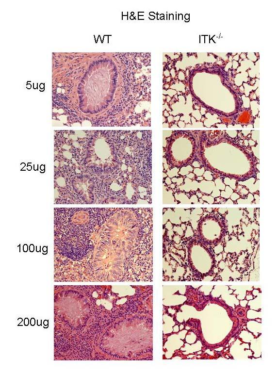 122 Figure 6.2: Reduced airway inflammation in mice lacking Itk after exposure to different doses of HDM.