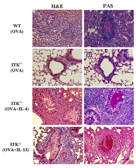 142 Figure 7.3: Rescue of airway inflammation and mucous production by addition of IL-4 and IL-13 cytokine in Itk null mice in response to OVA.