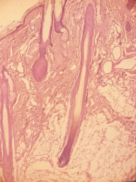 Papillary dermis: numerous cells Fibroblasts loose collagen type III: reticular fibers type VII: anchoring fibrils fine elastic fibers Capillaries and arteriovenous anastamoses