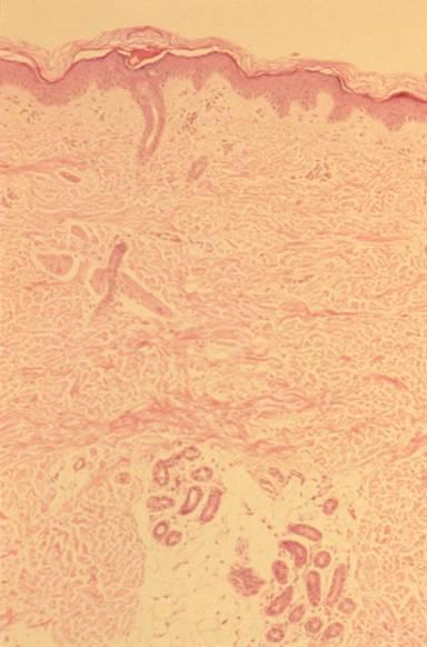 Eccrine Sweat Gland Simple coiled tubular gland Sympathetic, cholinergic innervation Duct Stratified cuboidal Opens on surface of epidermis Resorbs potassium, sodium and chloride ions