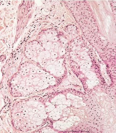 Gland Compound tubuloalveolar gland 15-20 lobes separated by connective tissue (collagen and adipose) each lobe is drained by a