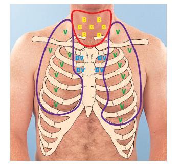 Auscultate from the apices of the lungs slightly above the clavicles to the bases of the lungs at the sixth rib.