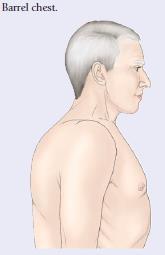 Spinous processes that deviate laterally in the thoracic area may indicate scoliosis.