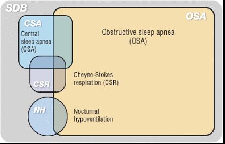 Overview of Sleep Apnea Sleep-Disordered Breathing (SDB) describes a number of nocturnal breathing disorders Sleep apnea is the dominant