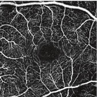 Visualize individual layers of vasculature.