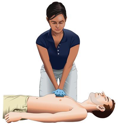 TABLE 2-1 CPR SKILL COMPARISON Skill Components Adult Child Infant HAND POSITION Two hands in center of chest (on lower half of sternum) Two hands in center of chest (on lower half of sternum) Two or