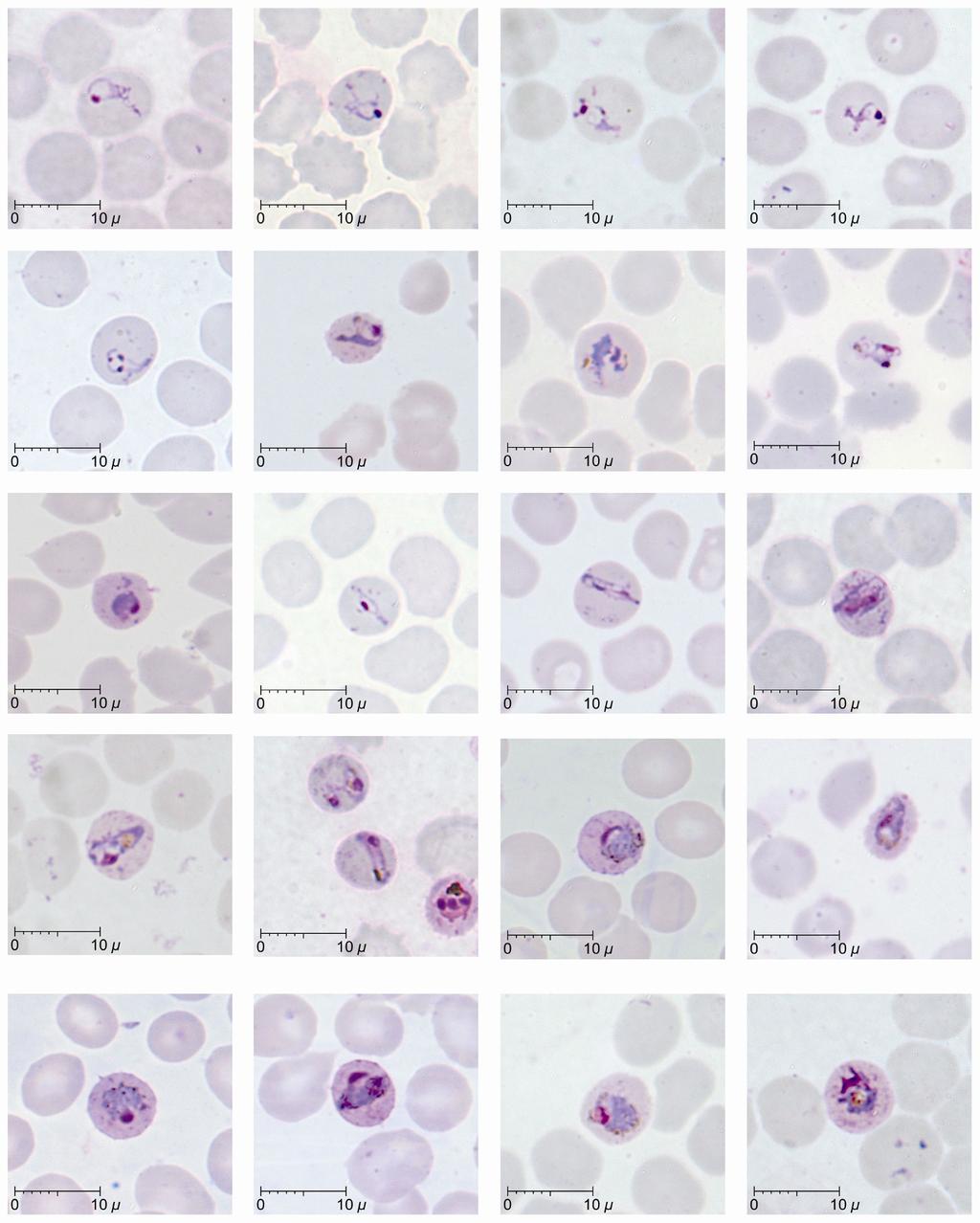 a b c d e f g h i j k l m n o p q r s t Late Figure (a-l) 2and mature (m-t) trophozoites of P. knowlesi parasites in human infections Late (a-l) and mature (m-t) trophozoites of P.
