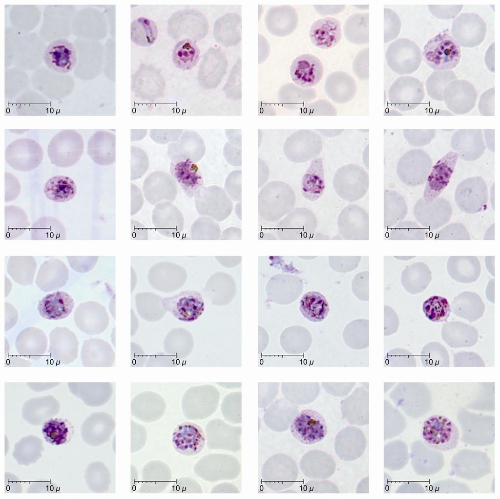 a b c d e f g h i j k l m n o p Schizonts Figure 3 of P. knowlesi parasites in human infections 
