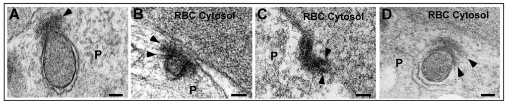 CYT, cytostome; P, parasite; RBC, red blood cell; PPM, parasite plasma membrane; PVM, parasitophorous vacuolar membrane. Scale bar: 100 nm.