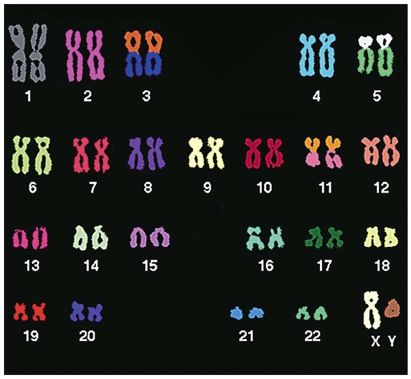 Sex linked genes any gene located on a sex chromosome