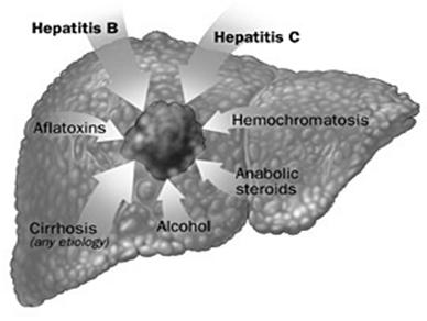 8% of cases are due to underlying chronic hepatitis B and C