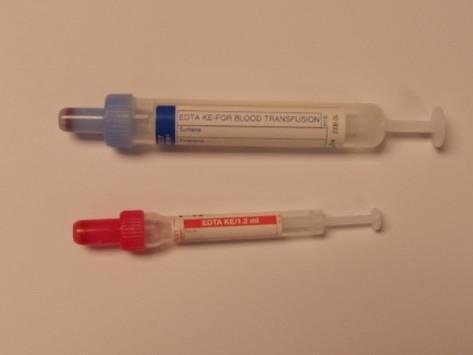 Cross- match A Group & Save request can be made into a crossmatch provided a current in date specimen is available. Specimen Blood Quantity7.5ml or 1.