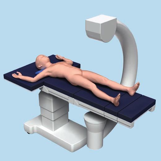 Patient Positioning and Approach 1 Positioning and preparation of the patient The operation is performed with the patient supine on a radiolucent table.