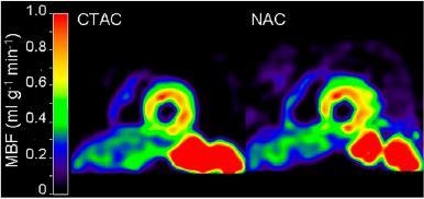 15O-water and PET Determined MBF Images (Short axis resting MBF images with (CTAC) and without (NAC)