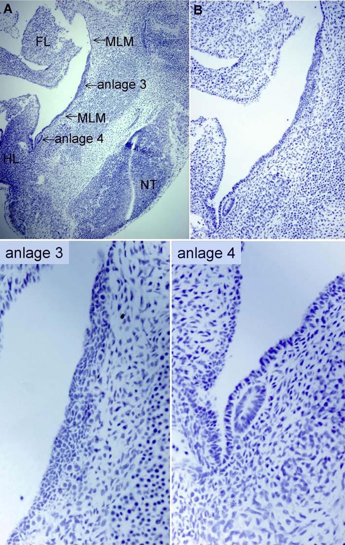 DOI: 10.1371/journal.pgen.0020112.g001 Figure 1. Mammary Anlagen (A) Mammary anlagen 3 and 4 are visible at E10.75/E11.