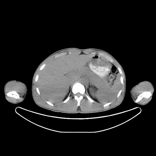 CT from PET/CT -