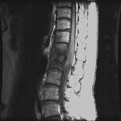 Case 4: Sensory MRI T spine (ER ordered L spine only) 8.