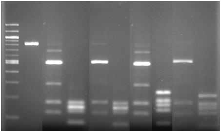 PCR-RFLP and Susceptibility Profiles of H.
