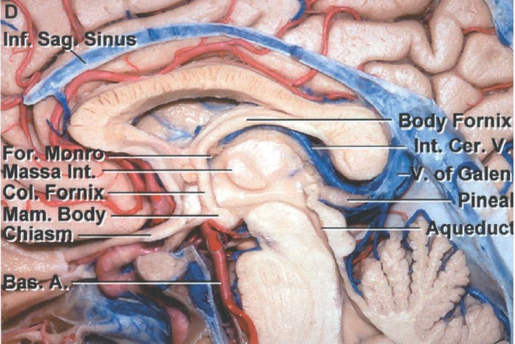 The pineal region anatomical Anatomy Bordered by CSF spaces (not bathed in CSF), Surrounded by pia Rostral: Posterior third ventricle Caudal: Quadrigeminal cistern Neural structures Ventral: