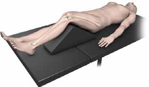 Surgical Technique Patient Positioning Position the patient supine on a radiolucent table with the unaffected limb extended away from the affected