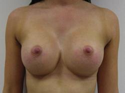 breast bone/ chest