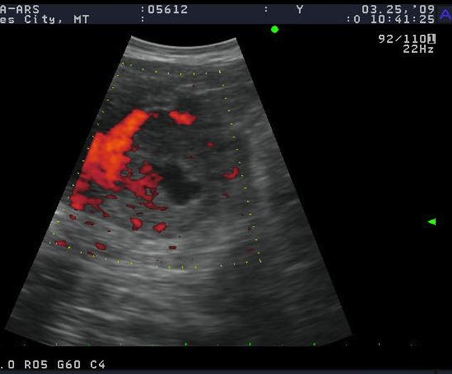 echotexture CL blood flow Current Technology Uterine (d 27) dependent Embryo Ultrasound MRP