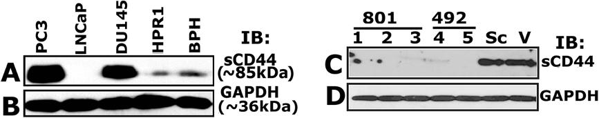 Gupta et al. Molecular Cancer 2012, 11:66 Page 5 of 17 Figure 3 Characterization of stable CD44 knockdown cell lines. A.