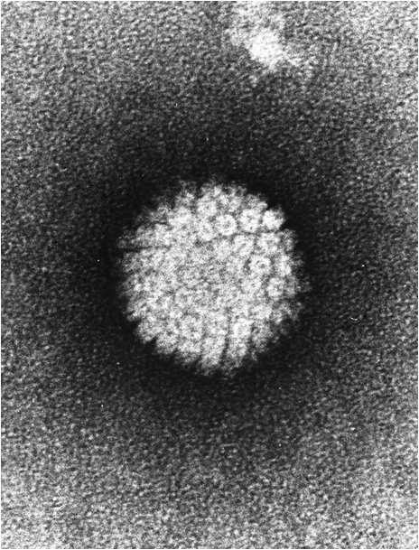 - L1 protein selfassembles into virus-like particles (VLPs) - VLPs are immunogenic - Antibodies to VLPs neutralize viral infectivity FDA-approved HPV vaccine products Bivalent (2vHPV): HPV16 and18