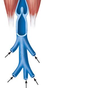 Muscles press against thin-walled veins Valve (open) Contracted skeletal muscle Valve (closed) Vein Direction of blood flow Figure 20.