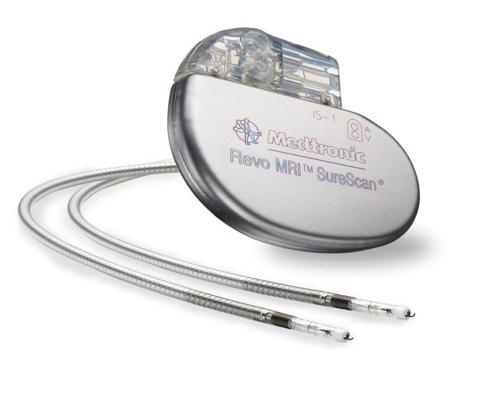 31 Pacemaker Procedures Insertion of generator ONLY to existing leads: 33212 - with existing single lead 33213 - with existing dual